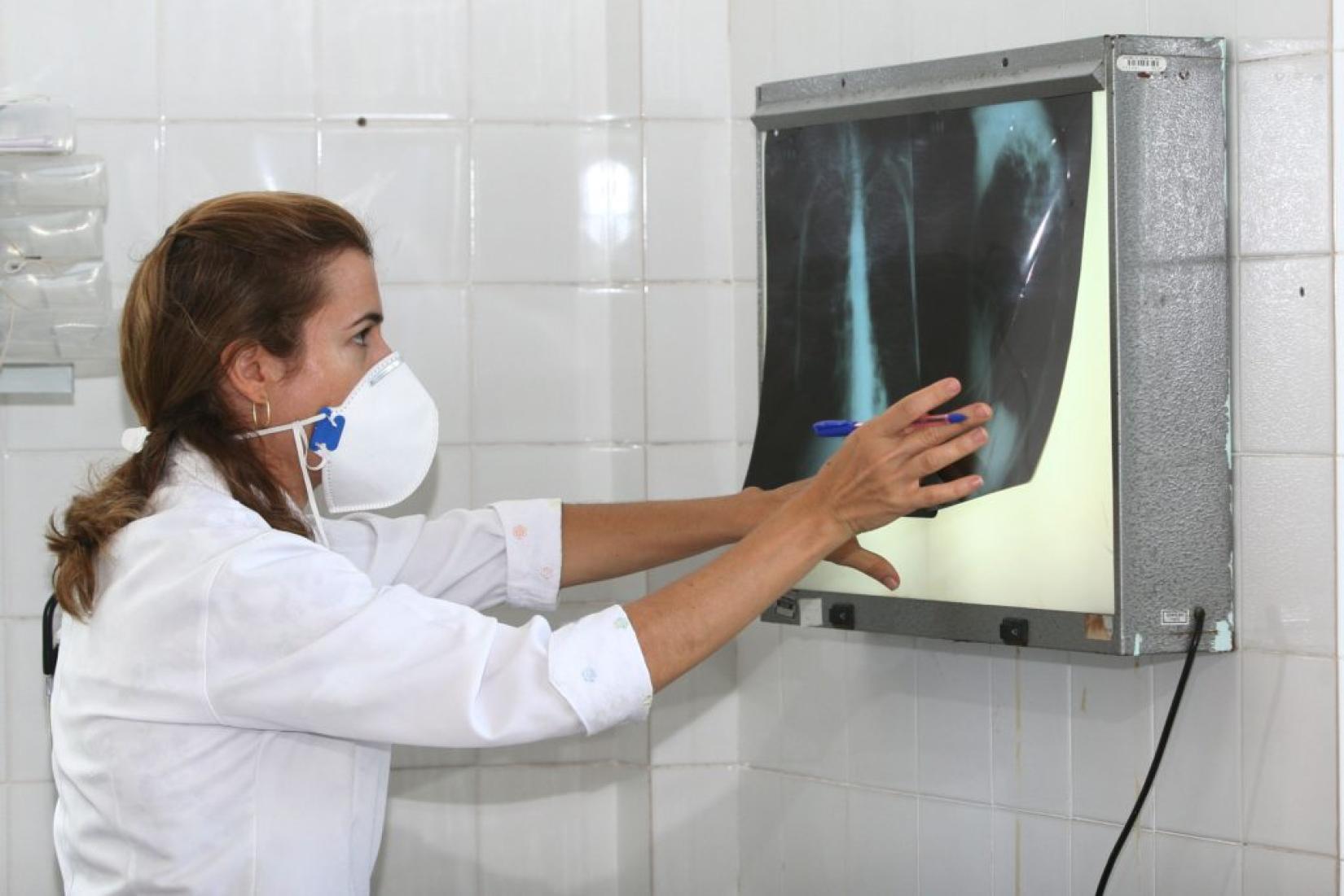 Médica analisa exame para eventual diagnóstico de tuberculose. Foto: AGECOM/Carol Garcia