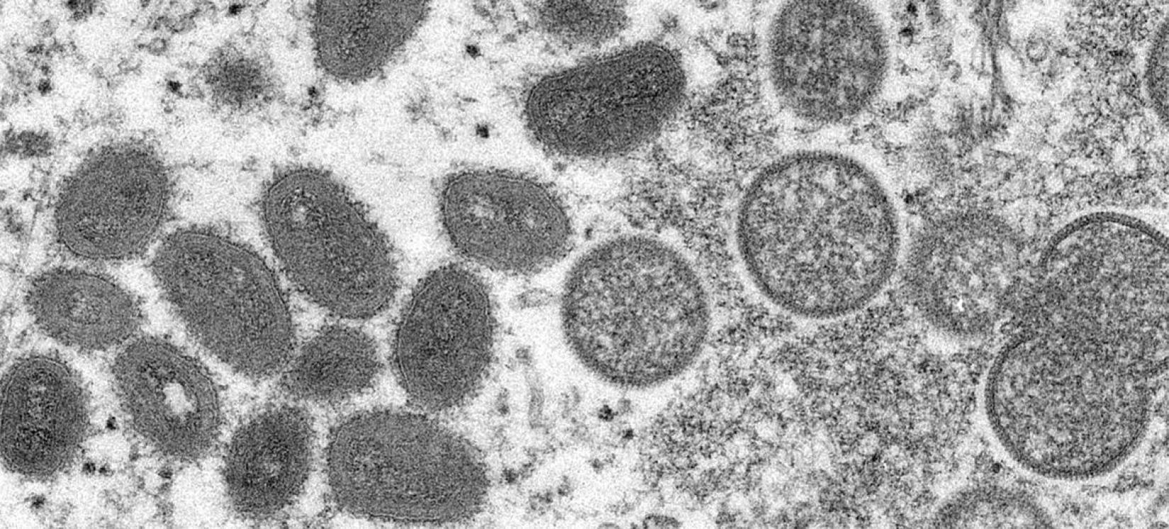 Desde 13 de maio de 2022, casos de varíola dos macacos foram relatados à OMS.