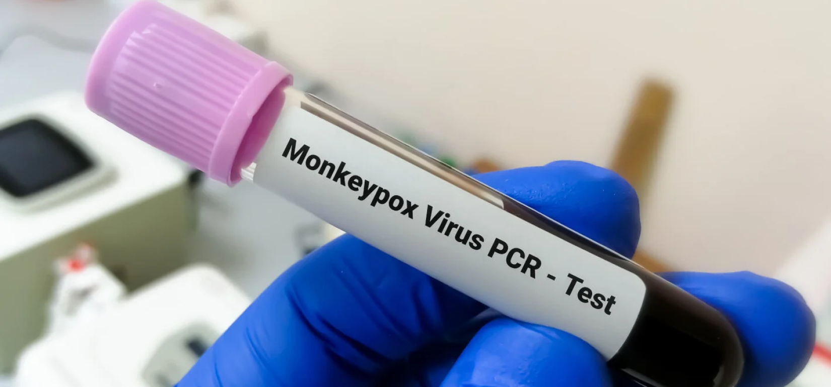 Não há tratamentos específicos para a infecção pelo vírus da varíola dos macacos. Os sintomas costumam desaparecer espontaneamente. 