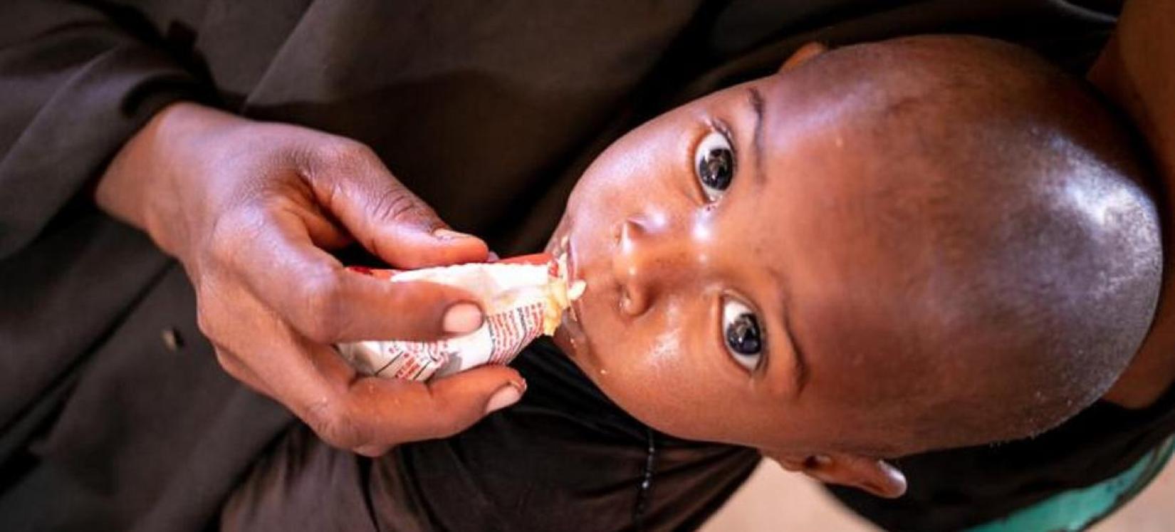 O UNICEF Somália oferece serviços de intervenção nutricional para crianças desnutridas.  