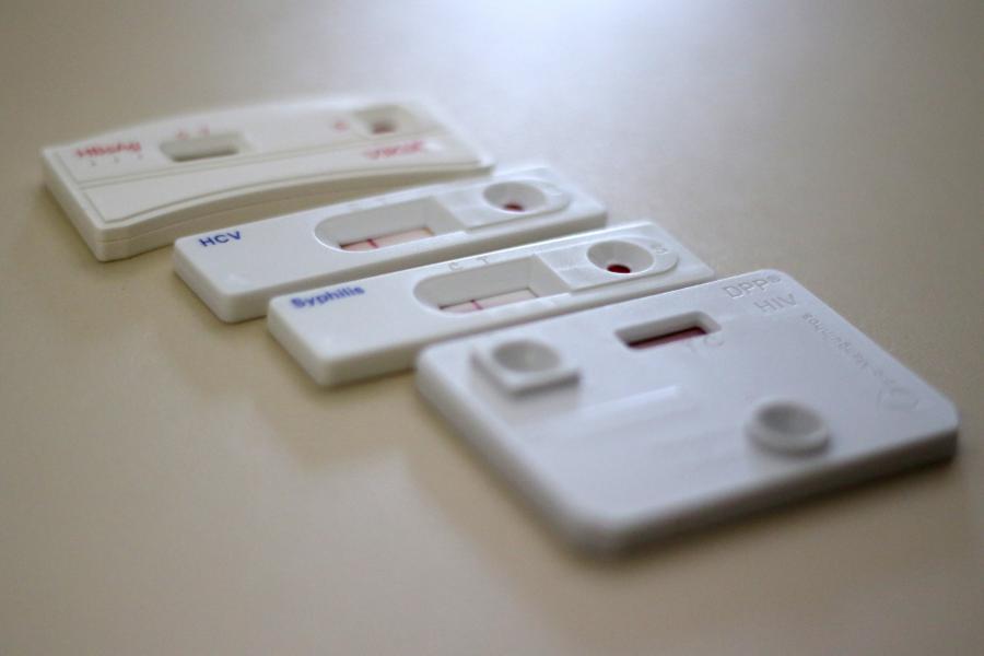 HIV pode ser detectado com auto teste