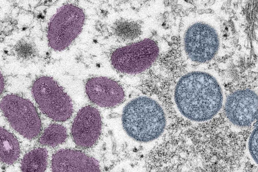 O vírus da varíola dos macacos é raro mas provoca infecção perigosa e similar à já erradicada varíola.